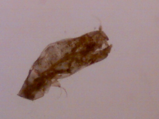 microinvertebrato? Copepode - con uova?